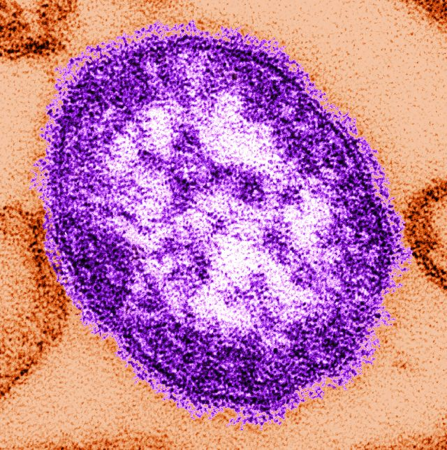 전자 현미경으로 촬영한 홍역 바이러스 입자로, 미국 질병통제예방센터(CDC) 제공. 연합뉴스