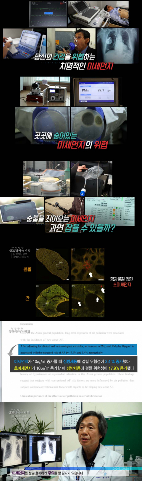 사진-'생로병사의 비밀' 예고편