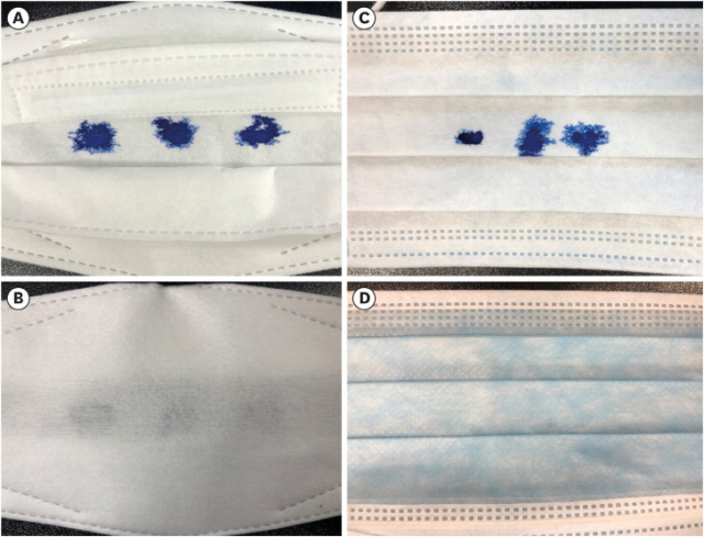 김미나 교수가 마스크의 안쪽 면에 파란색 염료를 떨어뜨린 결과. KF94마스크는 안쪽(A)에서 겉면(B)까지 염료가 비쳐 보였고, 덴탈마스크는 안쪽(C)에서 확산됐지만 겉면(D)은 건조한 상태를 유지했다. 대한의학회지 제공