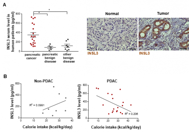 (A)췌장암 환자에서 INSL3 증가(그래프, 조직염색) (B)췌장암 환자에서 INSL3와 섭식장애 관계. 생명공학연구원 제공