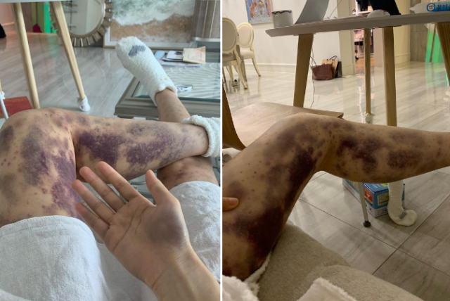 '아옳이' 인스타그램