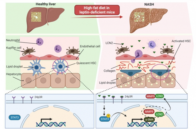 간별세포 활성화를 표적으로 하는 리포칼린-2에 의한 비알코올지방간염의 섬유화 촉진 기전 도식표. 경상국립대 제공