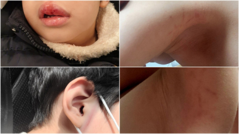 진주 아동학대 어린이집 추가 학대 정황