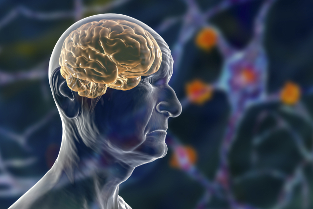 급성기 뇌졸중 적정성 평가는 머릿속의 혈관이 막히거나 터져서 뇌가 손상된 급성기뇌졸중 환자의 입원 치료에 대한 평가다. 부산에서는 7곳 병원이 1등급을 받았다. 클립아트코리아