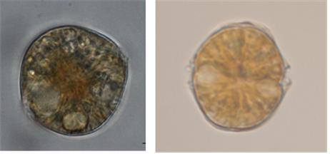 봄철 패류독소의 원인이 되는 유독성 플랑크톤 알렉산드리움. 해수부 제공
