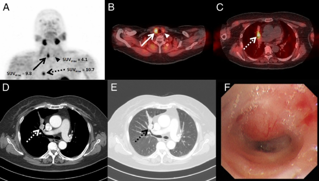 99mTc-MIBI SPECT/CT 결과. 동남권원자력의학원 제공