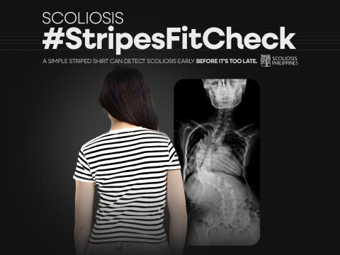 올해 부산국제마케팅광고제 공익 부문 대상을 받은 필리핀의 ‘척추 측만증 #줄무늬 티셔츠로 체크해’ 광고. 매드스타즈 제공
