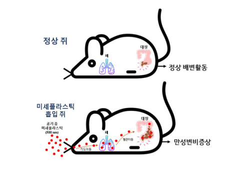 부산대·토론토대·인제대 공동연구, 장 질환과 미세플라스틱 인과관계 첫 규명