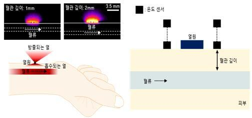 그림. 피부 근처 열 특성은 혈류속도 뿐만 아니라 혈관의 깊이에도 관련이 있다. 열원을 피부 위에 올려놓았을 때, 혈관의 깊이에 따라 피부에 흡수되는 열과 방출되는 열이 달라진다. 다층 열 센싱 기술을 통해 수평적인 열 특성과 수직적인 열 패턴을 동시에 파악한다. KAIST 제공