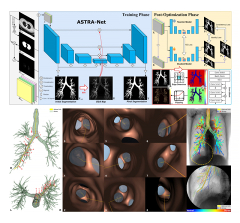 부산대·양산부산대병원, 기관지내시경 정밀도 향상 AI 모델 개발