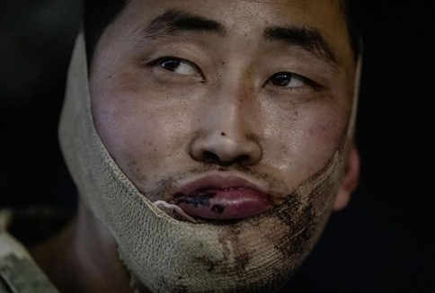 우크라이나군이 러시아 쿠르스크에서 생포한 북한군. 얼굴에 붕대를 감고 있다. 볼로디미르 젤렌스키 우크라이나 대통령 텔레그램 캡처. 연합뉴스